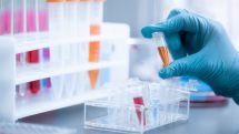 Armenia confirms 10 cases of British Covid-19 strain
