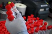 Коронавирус в Грузии: число инфицированных увеличилось за сутки на 2712, скончались 25 человек