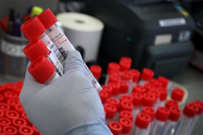 Коронавирус в Грузии: число инфицированных увеличилось за сутки на 2712, скончались 25 человек
