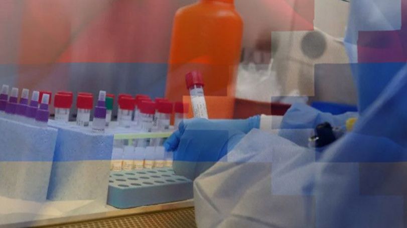 Artsakh reports no new COVID-19 case