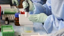 Armenia reports 329 new cases of COVID-19 on August 5