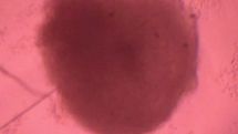 Mini-hearts grown to study disease