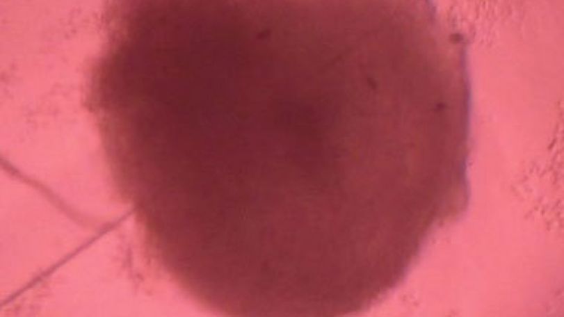 Mini-hearts grown to study disease