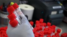 В Грузии за минувшие сутки от коронавируса скончались 74 пациента