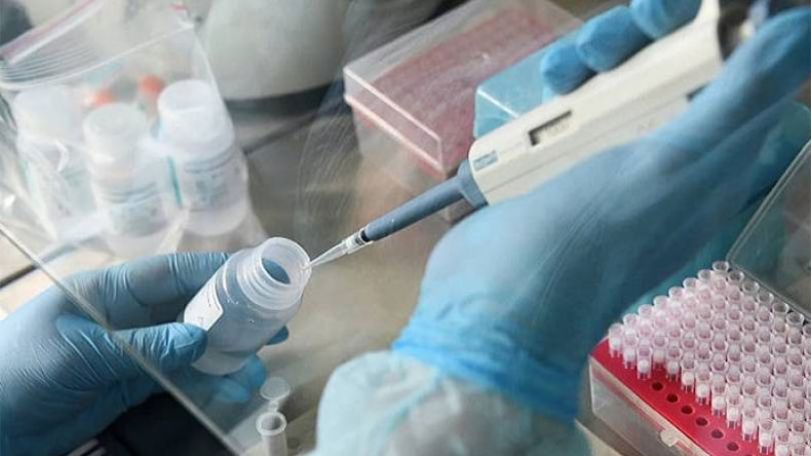 Artsakh reports 3 fresh coronavirus cases on September 7
