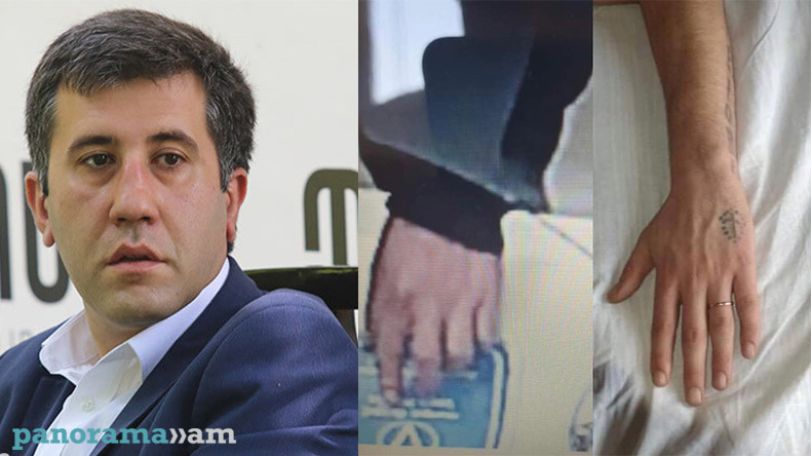 «Դաջվածքի գործով» անմեղ կալանավորը վերջապես ազատ է արձակվել