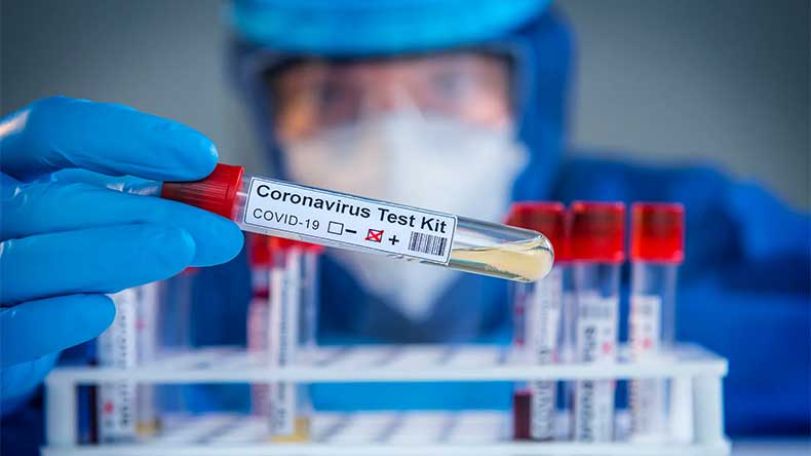 Armenia records 601 fresh Covid-19 cases on Oct. 11