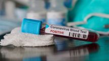 Armenia reports 2,193 fresh Covid cases on Oct. 30