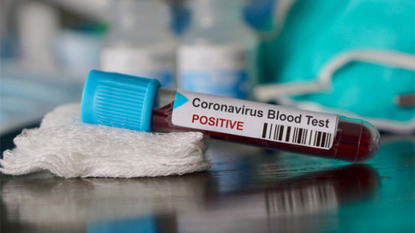 Armenia reports 2,193 fresh Covid cases on Oct. 30