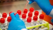 Число инфицированных коронавирусом в Грузии увеличилось за сутки на 6 024, скончались 49 человек