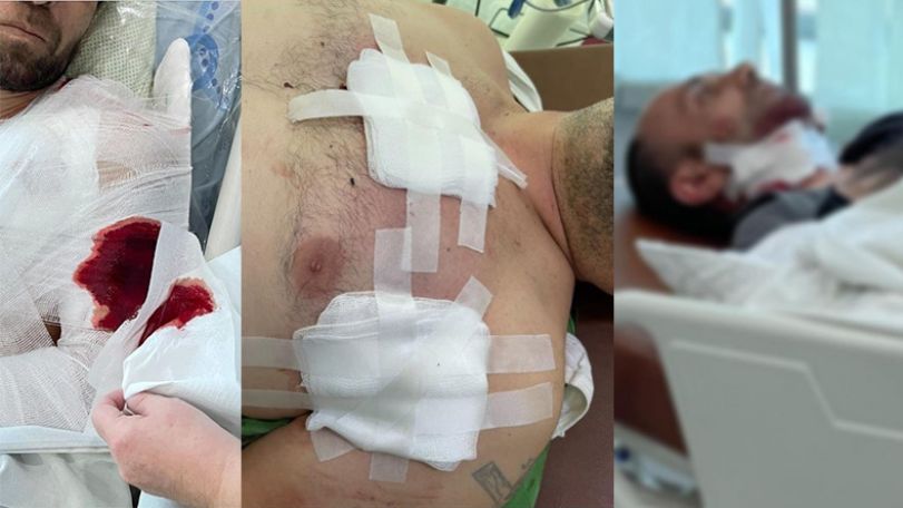 The condition of Artsakh civilians injured by Azeri forces remains of moderate severity