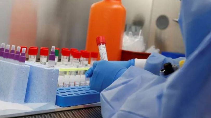 Artsakh records 45 fresh Covid cases in 24 hours