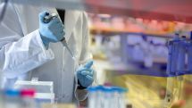 Armenia reports 398 fresh Covid cases on Nov. 30