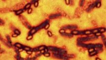 Anthrax risk for 75 scientists in US