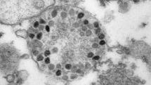 Omicron to infect more than half of Europeans in next two months, WHO says