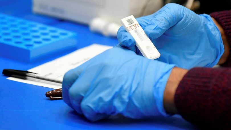 Armenia reports 1,362 fresh Covid cases on Jan. 31