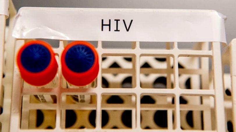 First woman in world believed to be cured of HIV