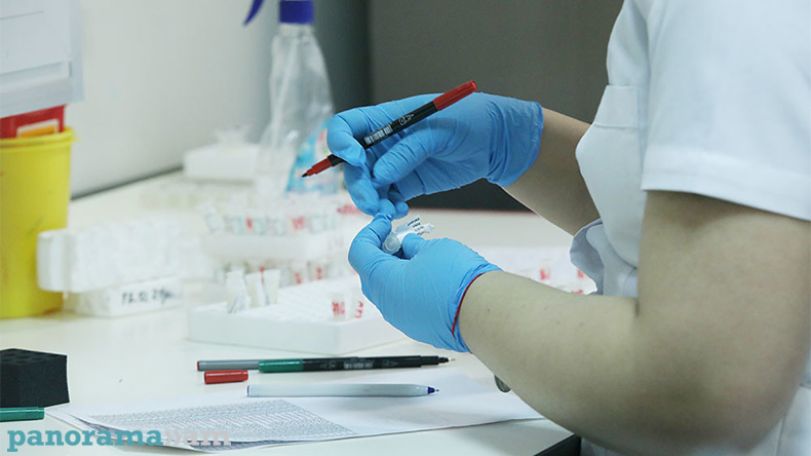 28.02.2022. В Армении подтверждено 139 новых случаев заражения COVID-19, скончались 12 человек