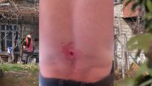 Житель Храморта получил ранение во дворе своего дома при проведении сельскохозяйственных работ – МВД Арцаха
