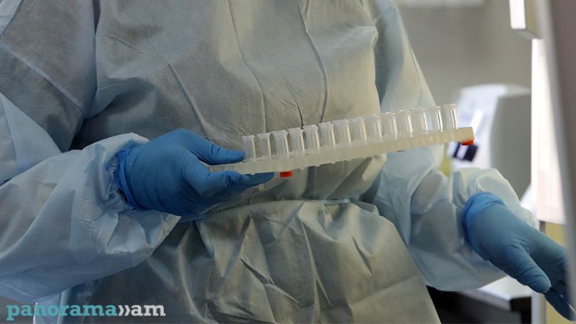 Armenian health authorities report 19 new Covid cases