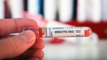 В Финляндии выявлен первый случай оспы обезьян