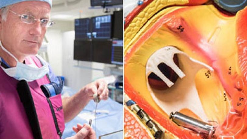 'World's smallest' pacemaker fitted for first time in England