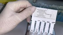 Russia donates monkeypox test kits to Armenia, other CIS countries