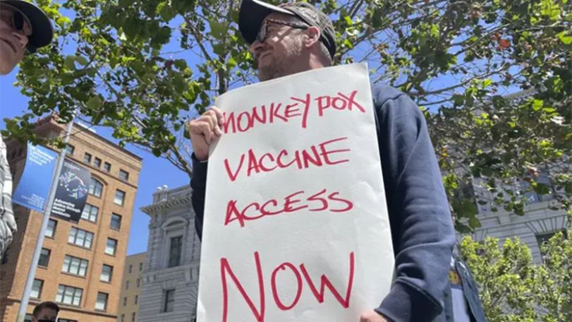 Monkeypox emergency declared in San Francisco