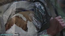 Аппарат Омбудсмена: Получившие ранения от выстрелов ВС Азербайджана военнослужащие остаются в госпитале