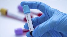 В России выявили максимальное число случаев коронавируса с 16 марта