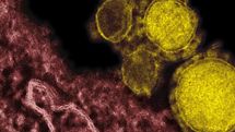 Saudi Arabia reports big jump in MERS cases, including 282 deaths