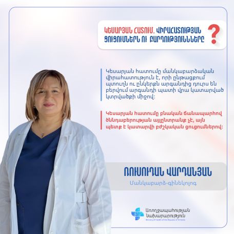 Կեսարյան հատում. վիրահատության բարդություններն ու ցուցումները