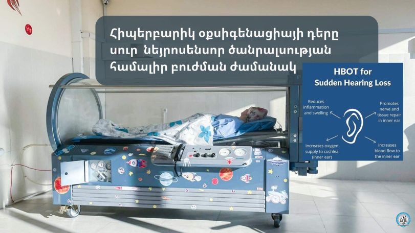 «Մուրացան». Ծանրալսության հիմքում 2/3 դեպքերում ընկած են անոթային հիվանդությունները