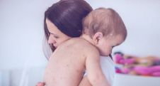 В Ленинградской области заболевание корью зарегистрировано у 74 человек