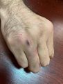 Armenian opposition MP broke his hand in parliament brawl, lawyer says