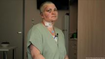 DW обнародовал фотографии: Так выглядит Елена Милашина после избиения в Чечне