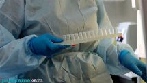 Armenia recorded 123 Covid cases in past two weeks, expert says