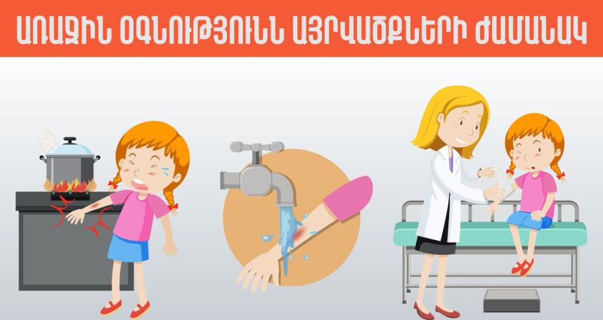 Ի՞նչ անել այրվածքների ժամանակ՝ ողբերգական դեպքերից խուսափելու համար