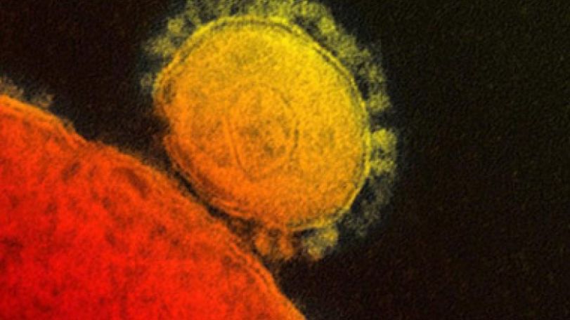 US confirms its first case of MERS virus