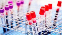 Scientists claim they can cut HIV out of cells