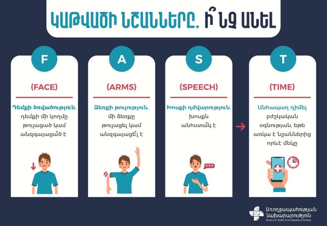 Կաթվածի նշանները. Ի՞նչ անել